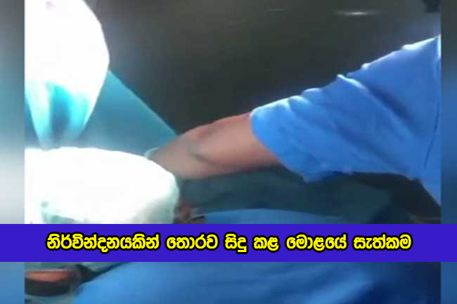Success Brain Operation in Badulla Hospital - නිර්වින්දනයකින් තොරව සිදු කළ මොළයේ සැත්කම